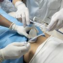 endometriosi Parc Sanitari Sant Joan de Déu