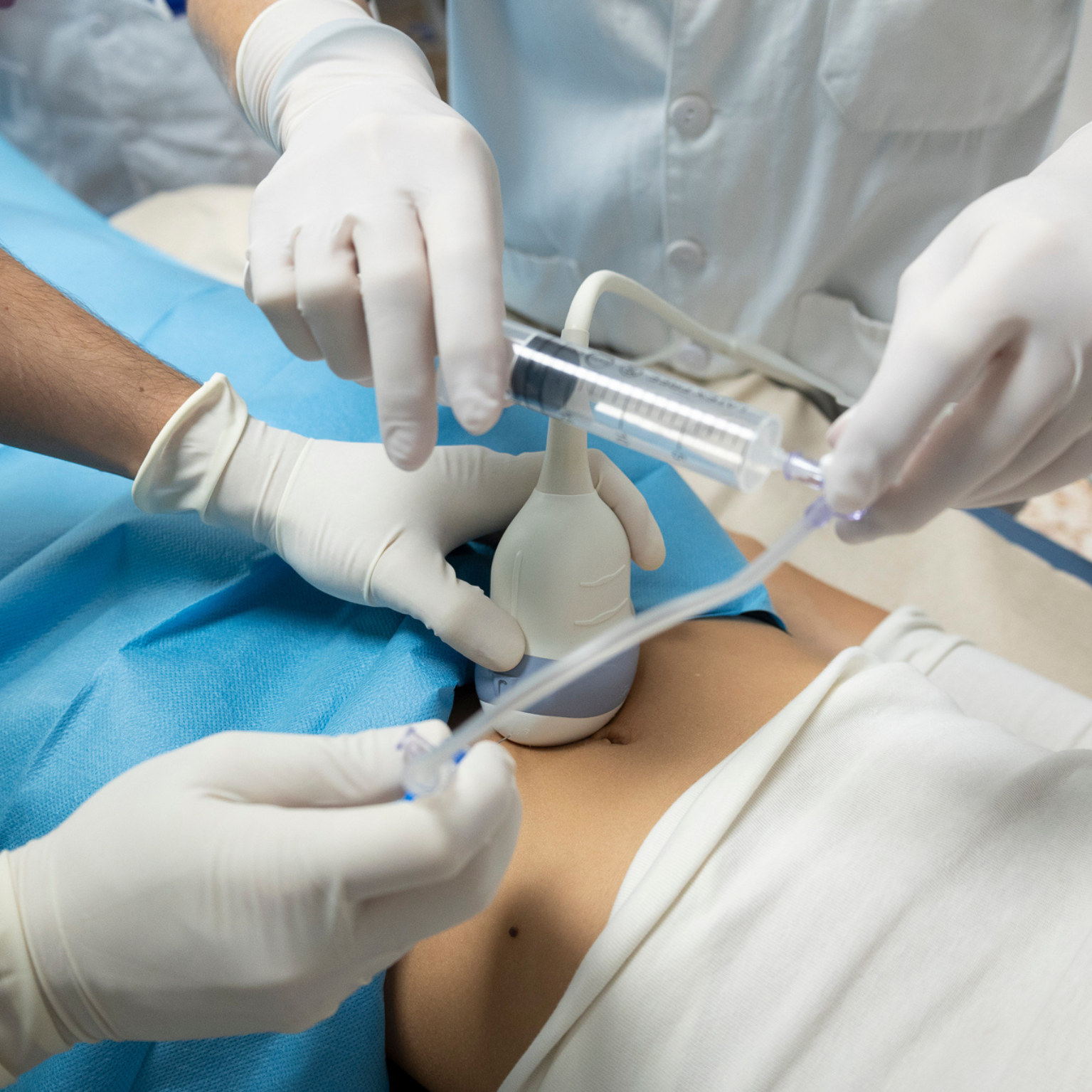 L’Hospital SJD Sant Boi participa en un assaig clínic per millorar el tractament de l’endometriosi