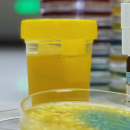 estudi-itus_1062x440 infeccions orina Parc Sanitari Sant Joan de Déu