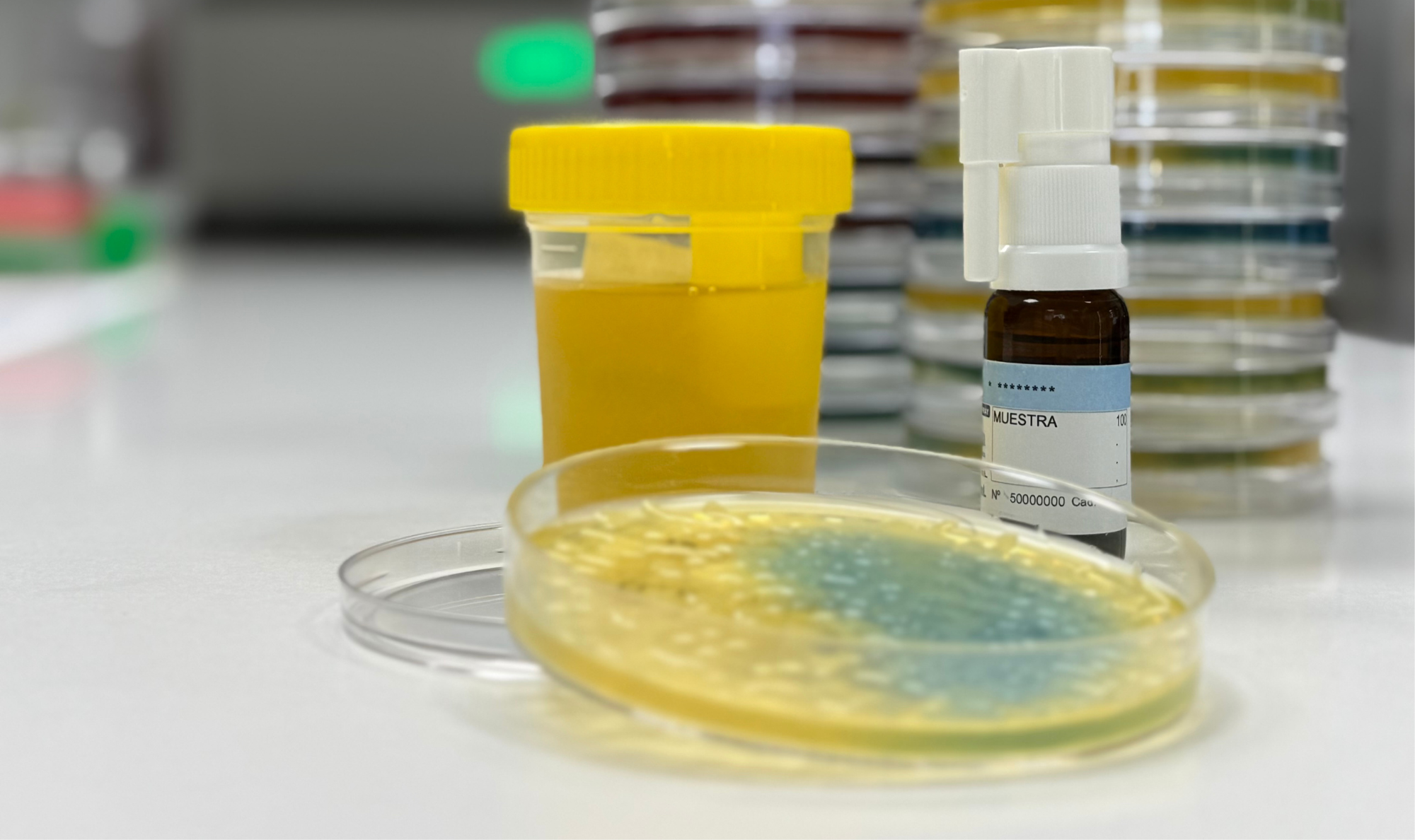 Una vacuna personalitzada posa fi a les infeccions d’orina de repetició